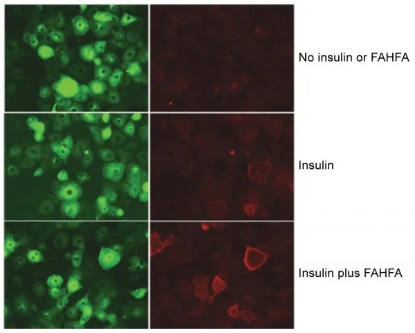 {'en': 'They discover a good fat against diabetes', 'es': 'Descubren una grasa buena contra la diabetes'} Image