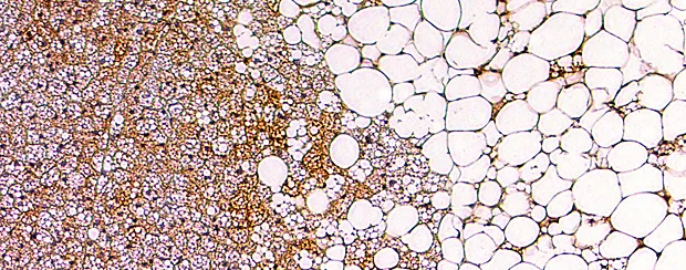 {'en': 'Better diabetes treatment through BAT activation', 'es': 'Mejor tratamiento de la diabetes a través de la activación del BAT'} Image