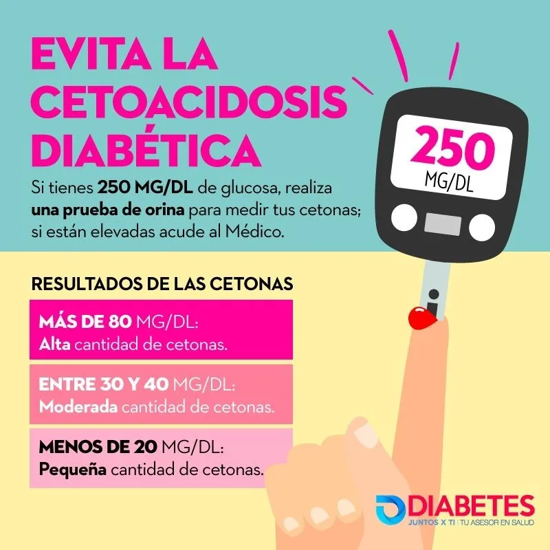 {'en': 'On ketoacidosis, how to recognize it?', 'es': 'Sobre la cetoacidosis, ¿como reconocerla?'} Image