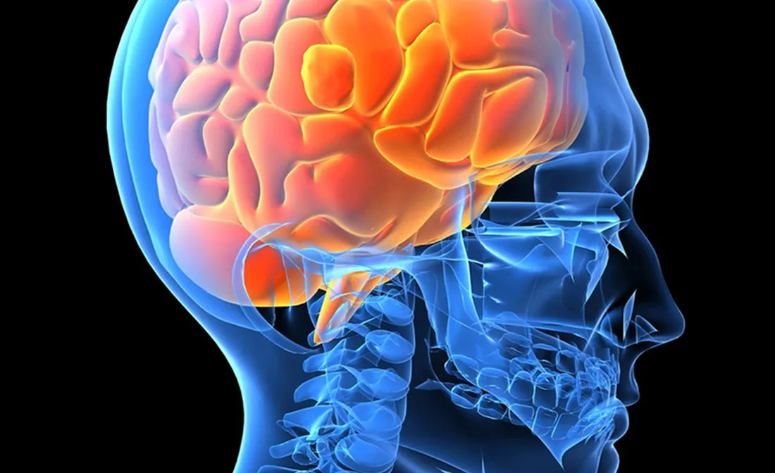 {'en': 'Cerebral edema due to sudden glycemia changes', 'es': 'Edema cerebral por cambios bruscos de la glucemia'} Image