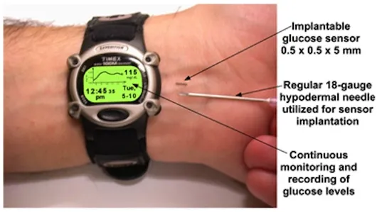 {'en': 'A microchip to control glucose: Glucowizzard', 'es': 'Un microchip para controlar la glucosa: glucowizzard'} Image