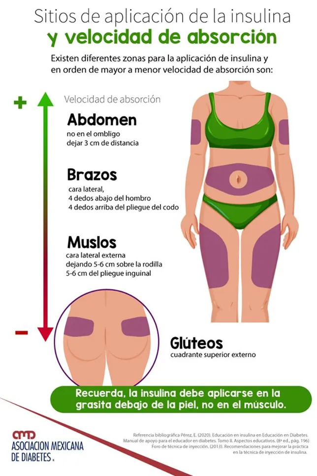 {'en': 'Insulin injection rotation but ... where is it better?', 'es': 'Rotación de inyección de insulina pero... ¿Dónde es mejor?'} Image