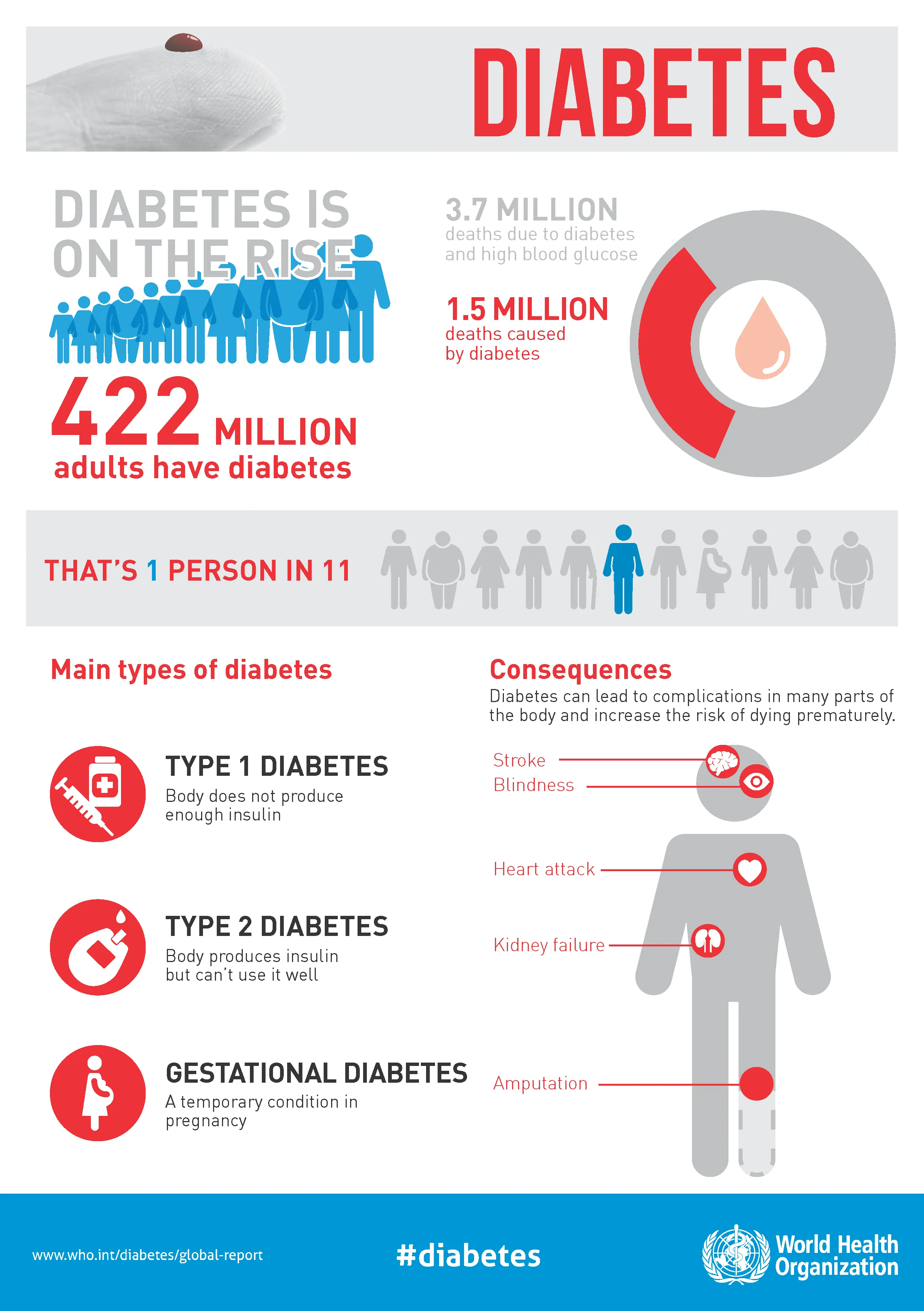 {'en': 'Diabetes will affect 1,300 million people in 2050, twice as much as', 'es': 'La diabetes afectará a 1.300 millones de personas en 2050, el doble que en la actualidad'} Image