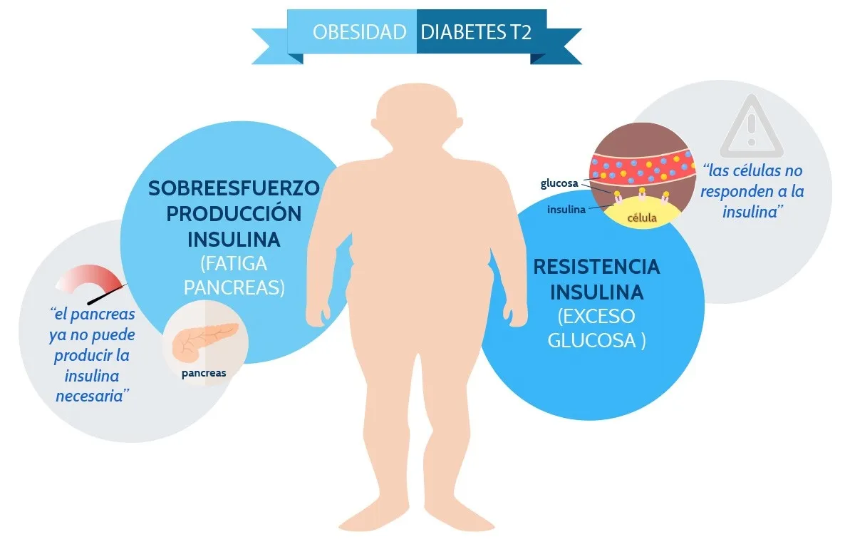 {'en': 'How overweight becomes diabetes?', 'es': '¿Como el sobrepeso se convierte en diabetes?'} Image