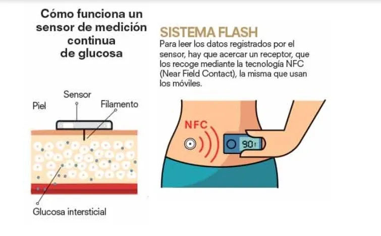 {'en': 'Question about the glycemia sensor', 'es': 'Pregunta sobre el sensor de glucemia'} Image