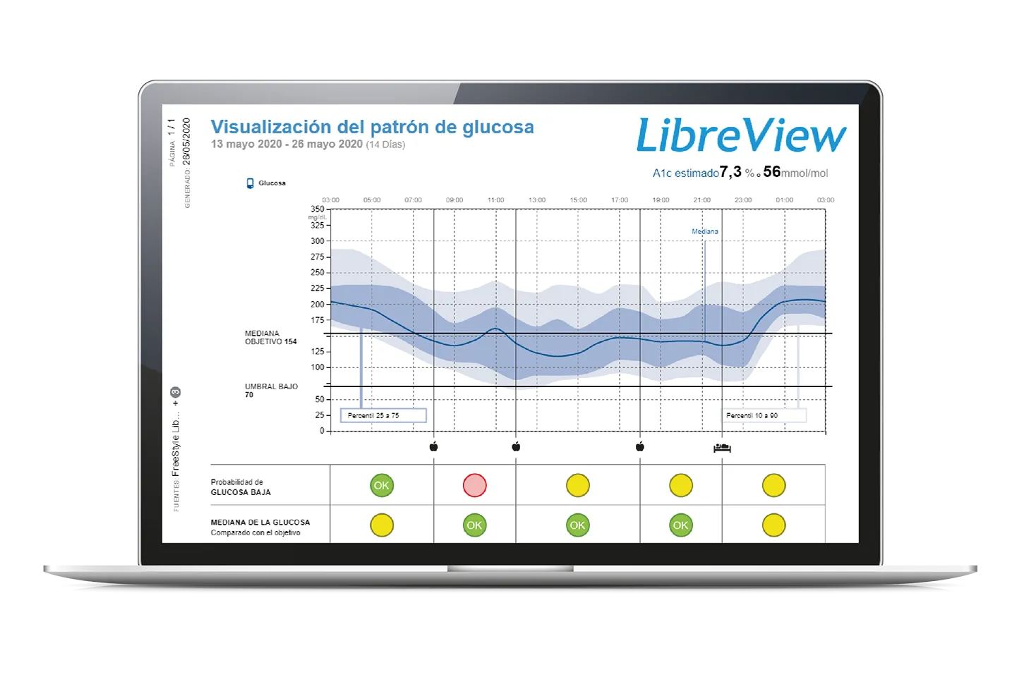 {'en': 'FreeView', 'es': 'Libreview'} Image