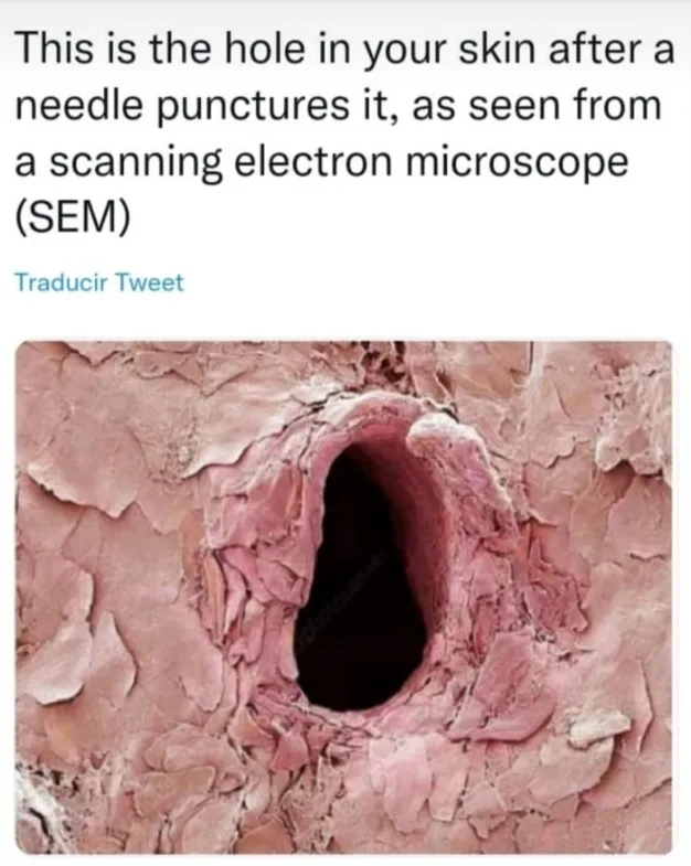 {'en': 'Curiosities: How to look like a microscope skin', 'es': 'Curiosidades: Cómo se ve un pinchazo en la piel al microscopio'} Image