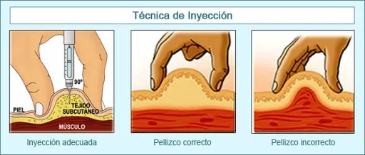 {'en': 'How do you do the pinch to click', 'es': 'Cómo hacéis el pellizco para pincharos'} Image