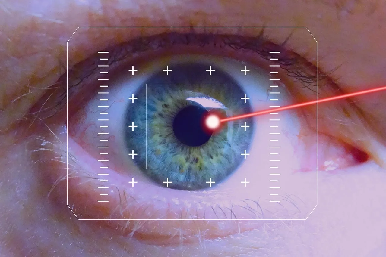 {'en': 'Ocular correction (operation) and type 1 diabetes', 'es': 'Correción ocular (Operación ) y diabetes tipo 1'} Image