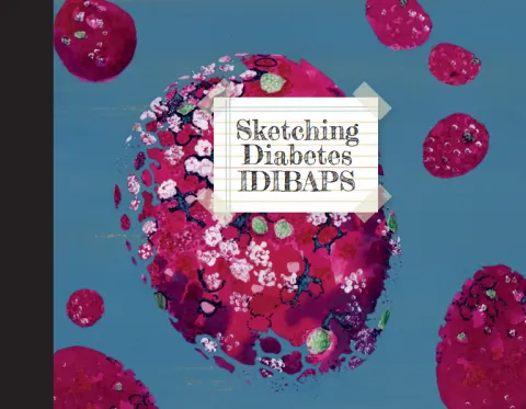 {'en': 'They improve pancreatic islet transplantation in diabetes', 'es': 'Mejoran el trasplante de islotes pancreáticos en diabetes'} Image