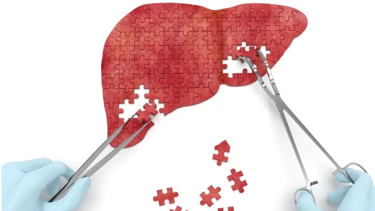 {'en': 'Insulin resistance can affect liver regeneration', 'es': 'La resistencia a la insulina puede afectar a la regeneración hepática'} Image