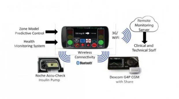 {'en': 'They try new artificial pancreas for patients with type 1 diabetes', 'es': 'Prueban nuevo páncreas artificial para pacientes con diabetes tipo 1'} Image