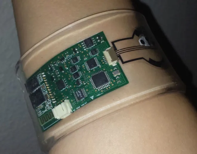 {'en': 'A bracelet to detect cystic fibrosis or diabetes with sweat', 'es': 'Una pulsera para detectar la fibrosis quística o la diabetes con el sudor'} Image