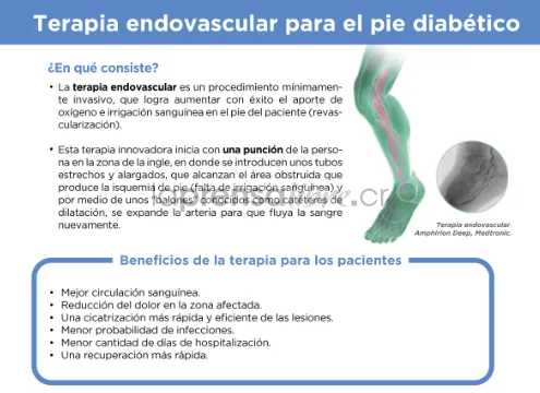 {'en': 'Therapy prevents 90% amputations by diabetic foot', 'es': 'Terapia previene 90% de amputaciones por pie diabético'} Image