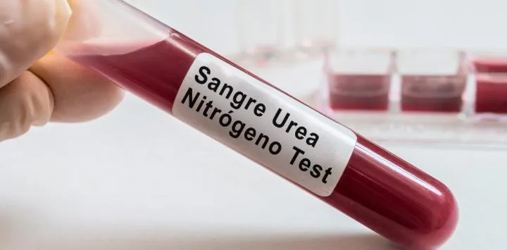 {'en': 'The blood urea level affects the risk of diabetes', 'es': 'El nivel de urea en sangre afecta al riesgo de diabetes'} Image