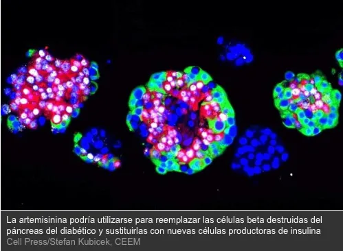 {'en': 'A new drug could cure type 1 diabetes', 'es': 'Un nuevo fármaco podría curar la diabetes tipo 1'} Image