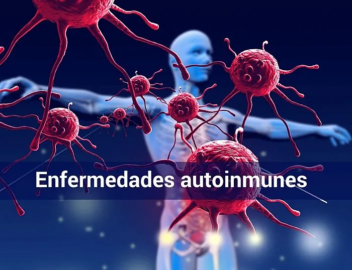 {'en': 'Study related type 1 diabetes with autoimmune diseases', 'es': 'Estudio relaciona diabetes tipo 1 con enfermedades autoinmunes'} Image