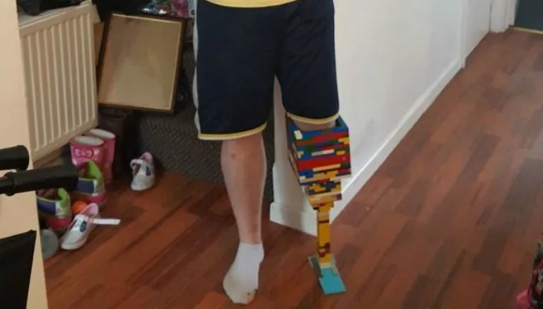 {'en': "Young manufactures a 'lego leg' to raise awareness about diabetes", 'es': "Joven fabrica una 'pierna de Lego' para concientizar sobre la diabetes"} Image