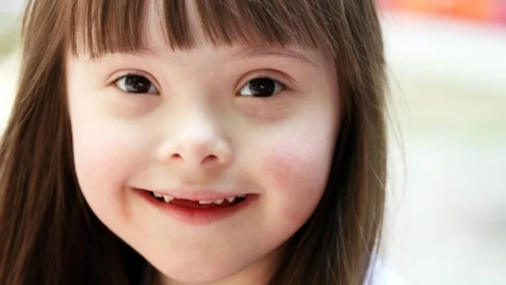 {'en': 'Type 2 diabetes medications could be developed thanks to Down Syndrome', 'es': 'Medicamentos para la diabetes tipo 2 podrían desarrollarse gracias al Síndrome de Down'} Image