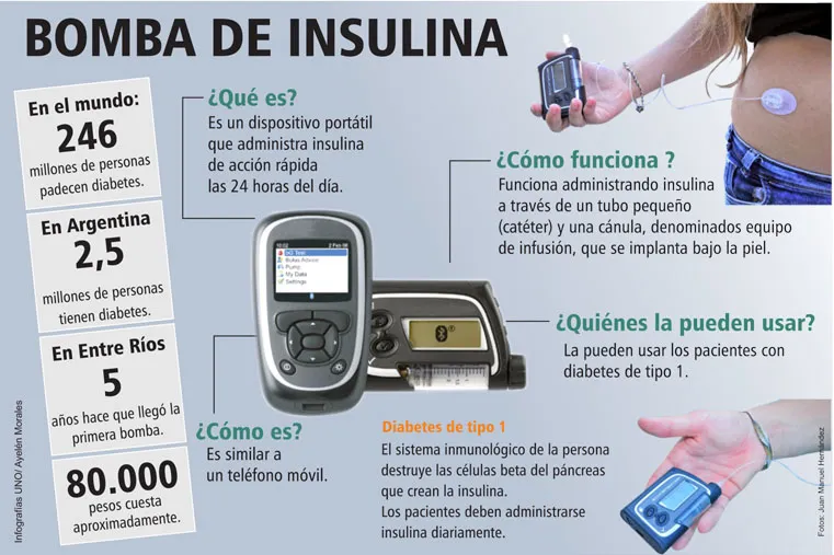 {'en': 'Pros and cons insulin bombs', 'es': 'Pros y Contras bombas de insulina'} Image