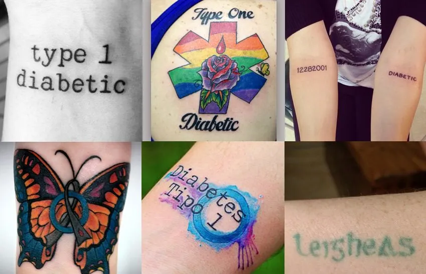 {'en': "Tattoos (tattoo's) for diabetes", 'es': "Tatuajes (Tattoo's) por la diabetes"} Image