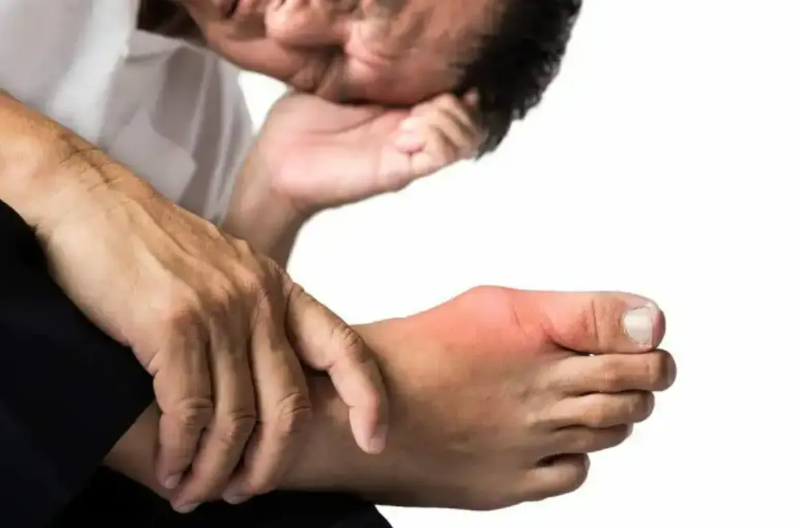 {'en': 'Diabetic Neuropathy', 'es': 'Neuropatia diabetica'} Image