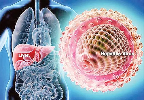 {'en': 'Hepatitis C predisposes to type 2 diabetes', 'es': 'La hepatitis C predispone a la diabetes tipo 2'} Image