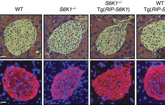 {'en': 'S6K1 protein could help treat type 2 diabetes', 'es': 'La proteína S6K1 podría ayudar a tratar la diabetes tipo 2'} Image