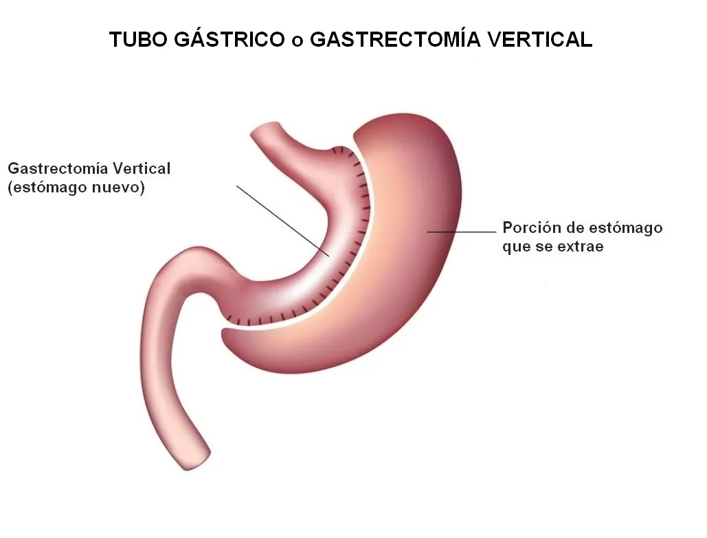 {'en': 'Bellvitge organizes an international course on diabetes surgery', 'es': 'Bellvitge organiza un curso internacional sobre cirugía de la diabetes'} Image